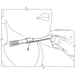 ARK Probe Tip Mini końcówka do wibratora logopedycznego, gryzak - miękka