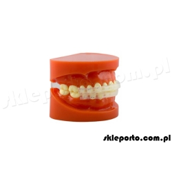 Ochraniacz wargowy silikonowy Comfort Cover ortodontyczny  - osłona ortodontyczna