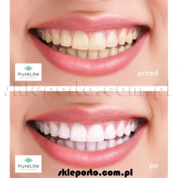 PureLite Professional 5 ml żel do wybielania zębów - wybielanie