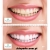 PureLite Professional 5 ml żel do wybielania zębów - wybielanie